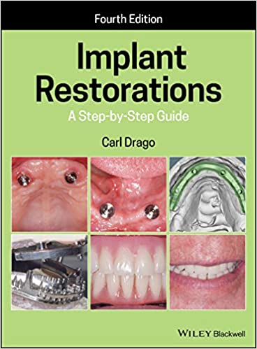 Implant Restorations: A Step-by-Step Guide (4th Edition) - 9781119538110