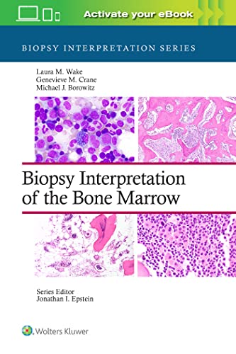 Biopsy Interpretation of the Bone Marrow (Biopsy Interpretation Series) - 9781496300591