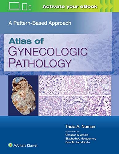 Atlas of Gynecologic Pathology: A Pattern-Based Approach - 9781975124762