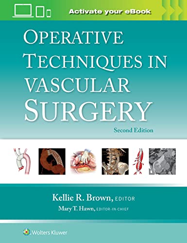 Operative Techniques in Vascular Surgery (2nd Edition) - 9781975176648