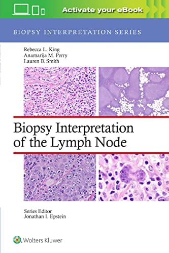 Biopsy Interpretation of the Lymph Node (Biopsy Interpretation Series) - 9781975184629