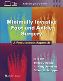 Minimally Invasive Foot and Ankle Surgery - 9781975198701