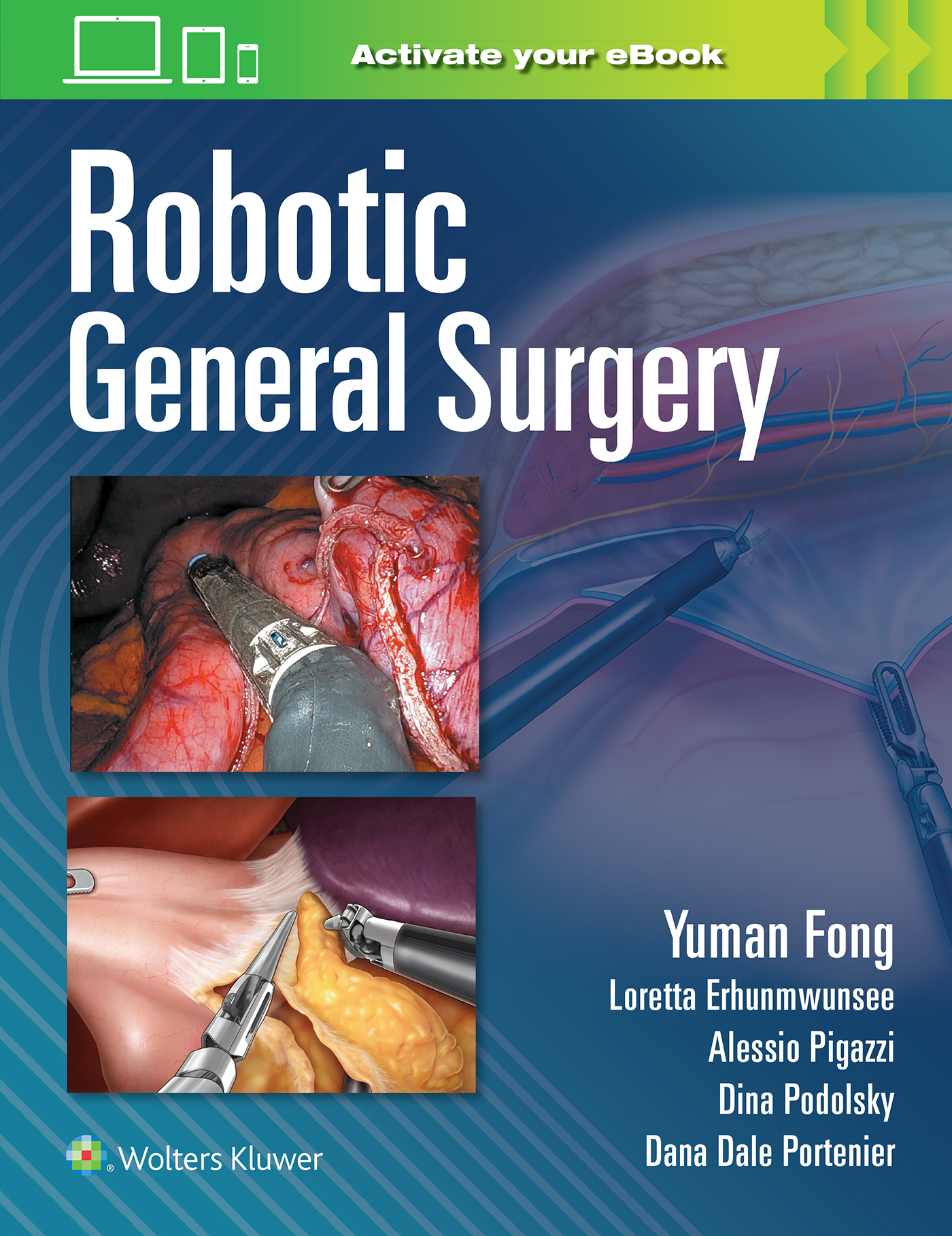 Robotic General Surgery - 9781975192648